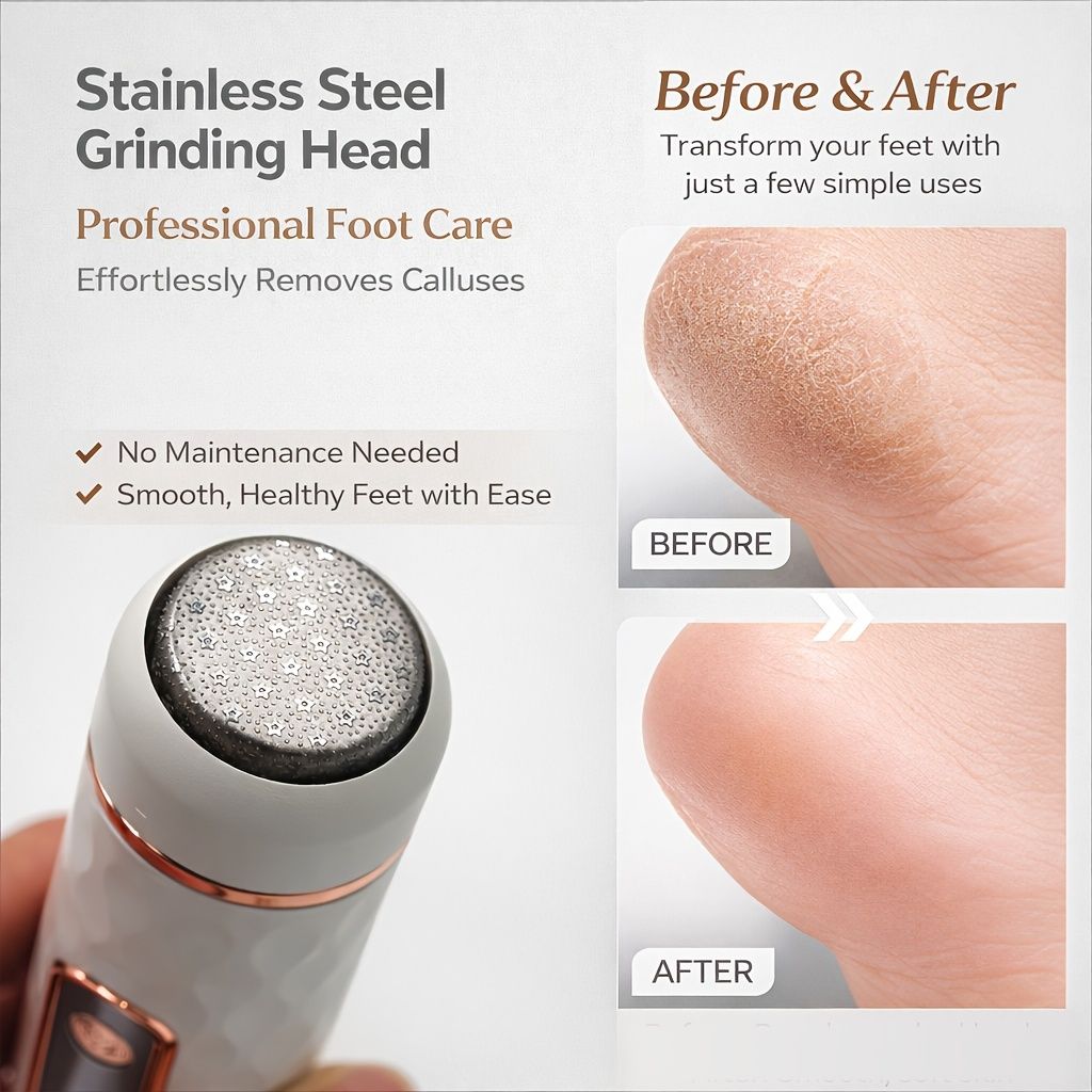 Electric Foot Callus Remover | USB Rechargeable - Image 3