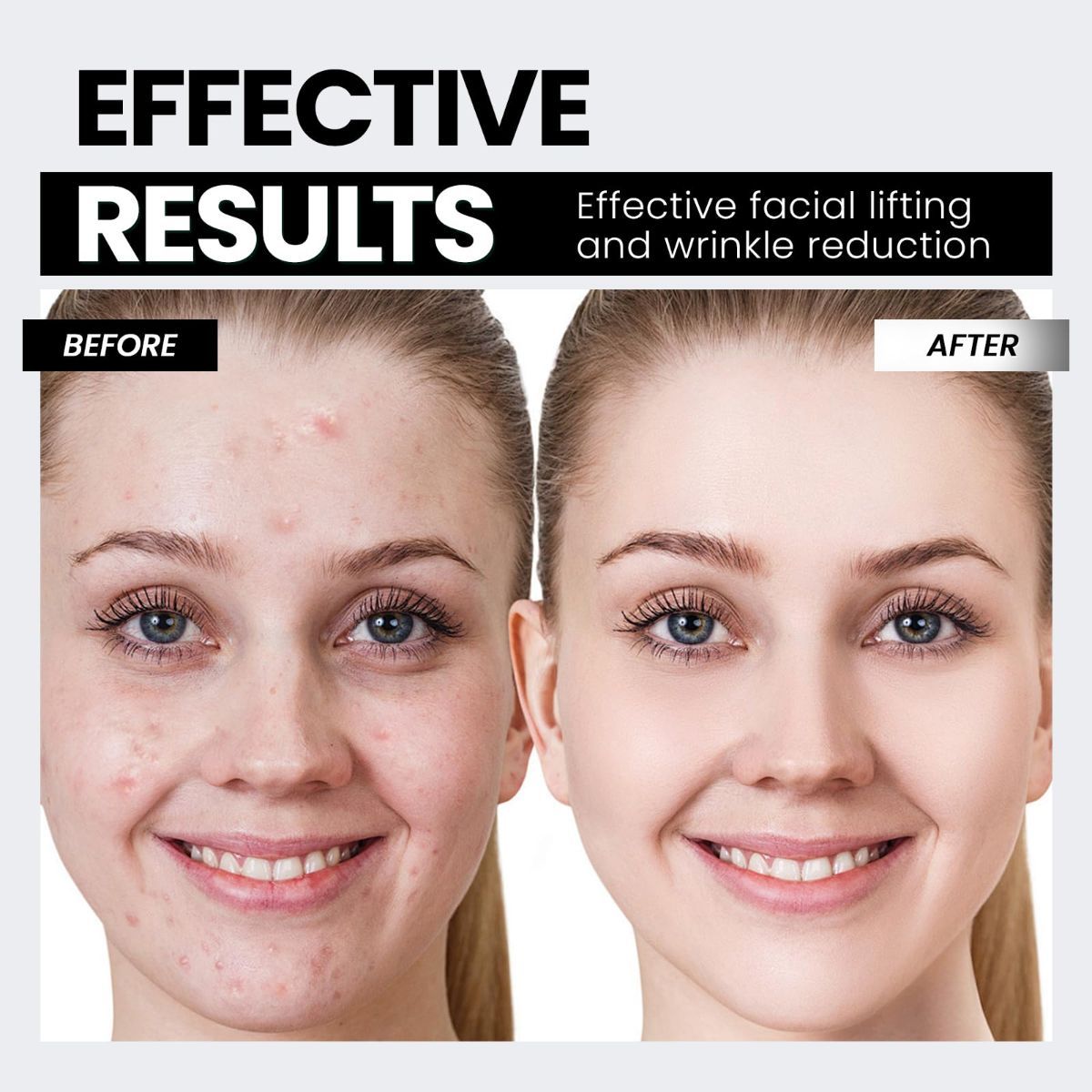 Microcurrent Facial Device,Latest Red Light Technology，Enhances The Ability to Lift The Face and Tighten The Skin，Facial Wrinkle Equipment，Smart Photon Micro-Current Device - White - Size 15cm - Image 3