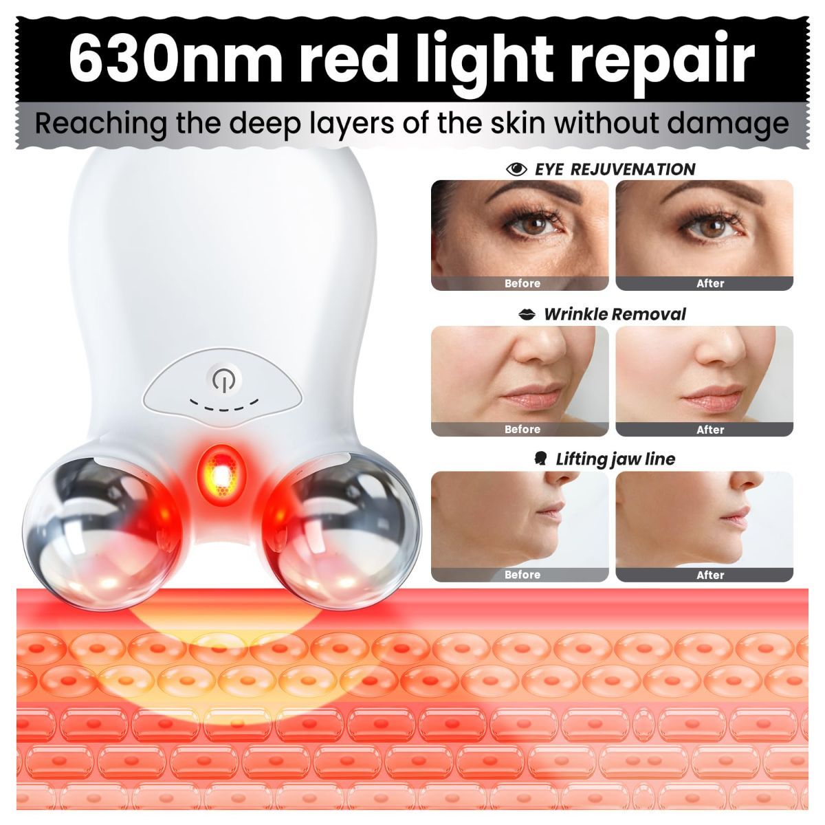 Microcurrent Facial Device,Latest Red Light Technology，Enhances The Ability to Lift The Face and Tighten The Skin，Facial Wrinkle Equipment，Smart Photon Micro-Current Device - White - Size 15cm - Image 5