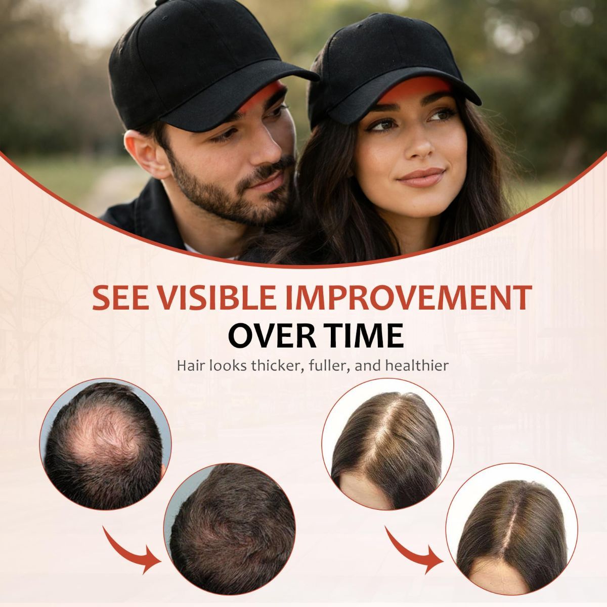 Laser Hair Growth Cap - 650nm Red Light Therapy for Hair Regrowth, Full Scalp Coverage Treatment for Men & Women with Thinning Hair, Portable & Hands-Free, Black - Image 4
