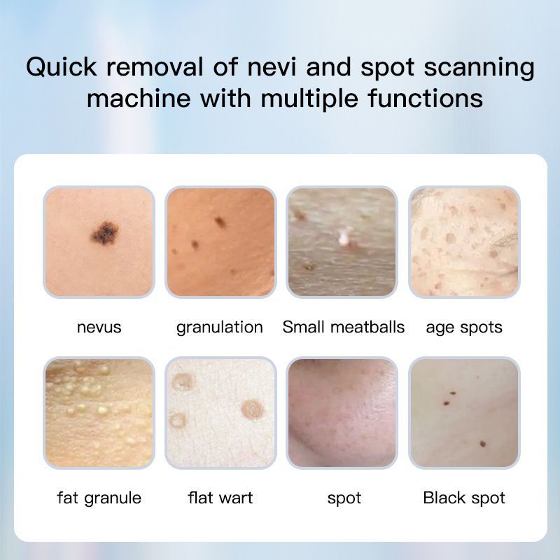 Dotting Mole Pen Nevus Removal Tool Spot Remover Red Blue Light Therapy Beauty - Image 5