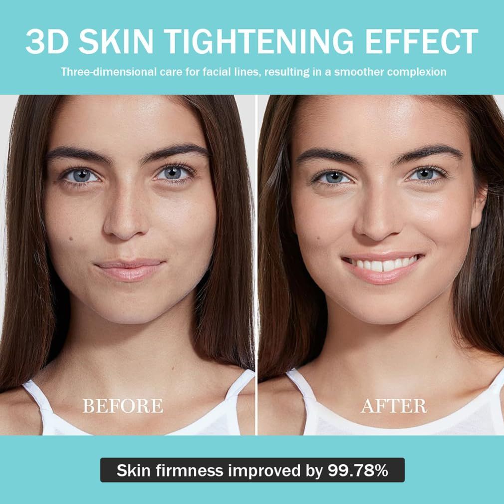 Upgraded Version | Skin Care Device - Facial Glow Booster for Maximizing and Boosting Absorption - Needle Free, Radiance, Elasticity | LED Anti-Wrinkle Device | Skin Care Firming, Toning - Image 3