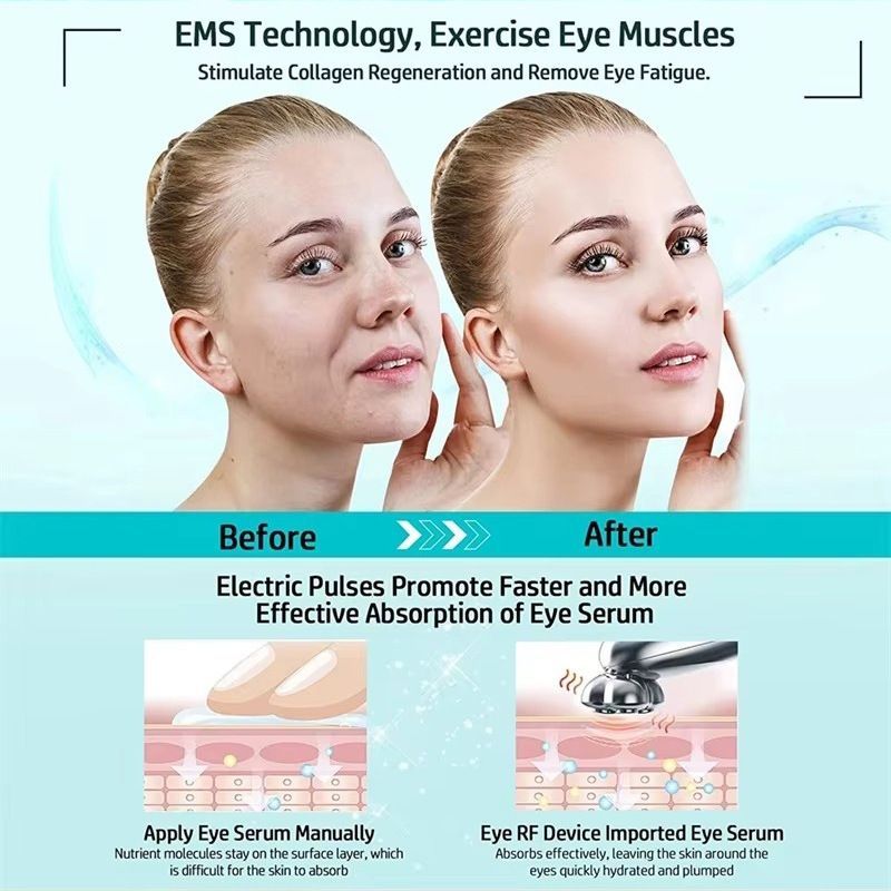 Eye Beauty Device Eye Care Anti-Aging Dark Circles Puffiness Fine Lines - Image 3