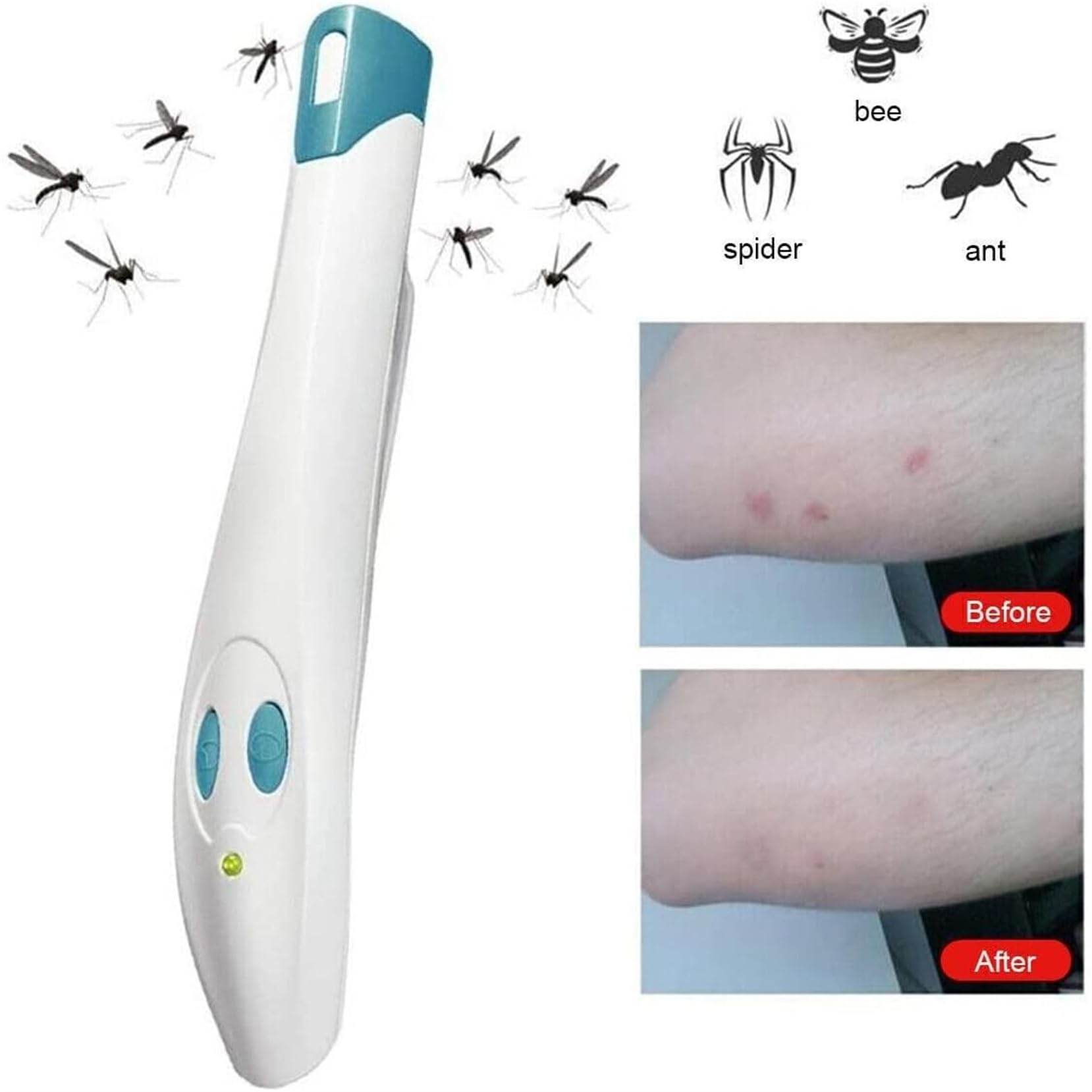Portable Anti-Itch Pen for Bug Bites – Electronic Relief Device for Mosquito, Bee, Spider & Ant Stings, Chemical-Free Pain Relief, Instant Soothing (White) - Image 2