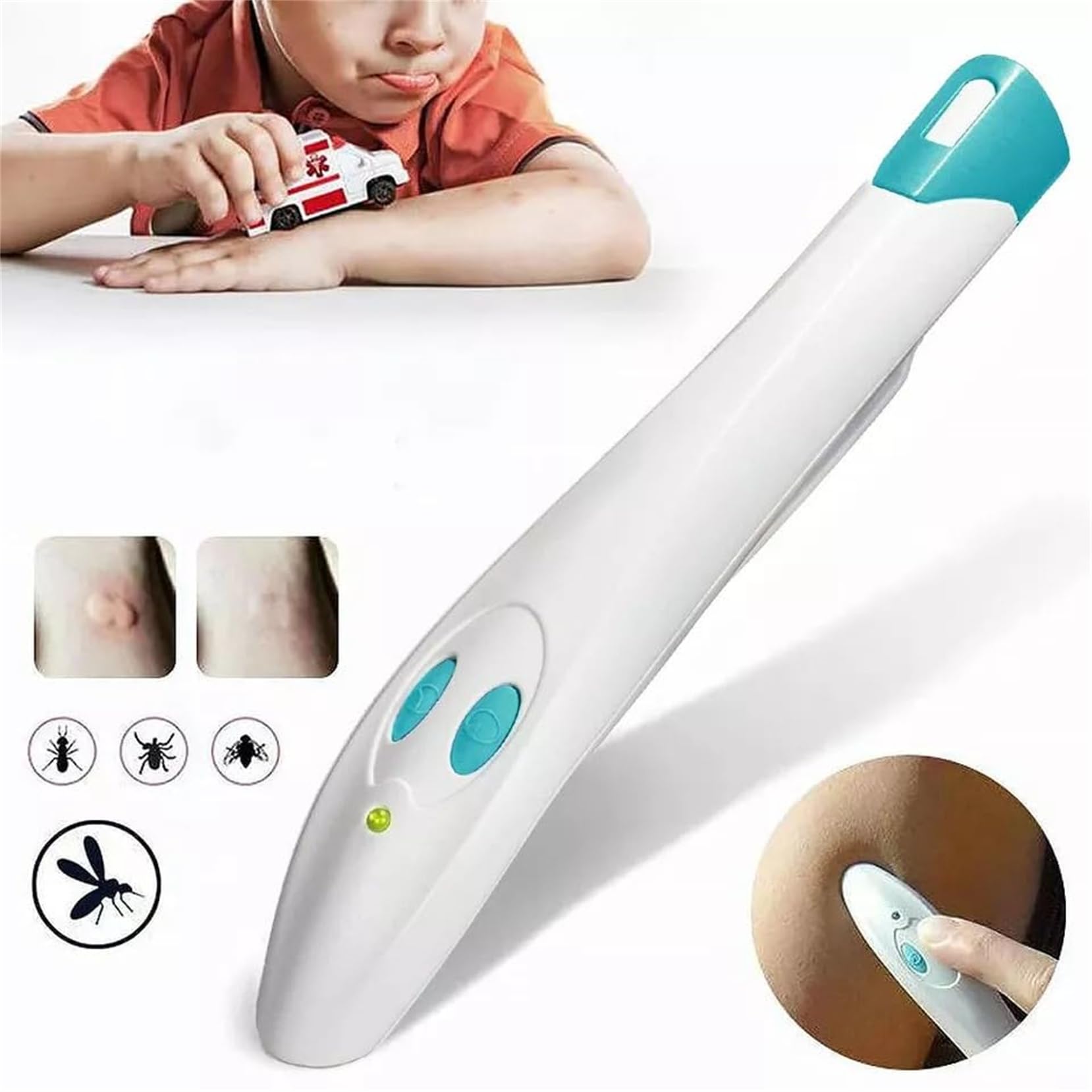 Portable Anti-Itch Pen for Bug Bites – Electronic Relief Device for Mosquito, Bee, Spider & Ant Stings, Chemical-Free Pain Relief, Instant Soothing (White) - Image 7