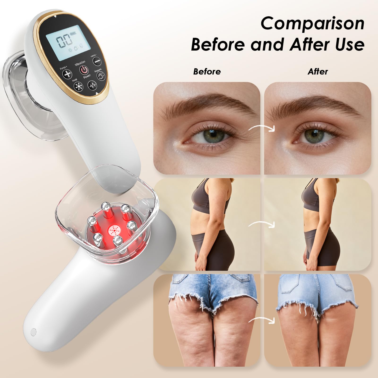 Modern Jingluo Beauty Massager – Electric Meridian Facial & Body Roller with Gentle Suction and Warmth, Multi-Speed Skincare Tool for Relaxing Rituals (White) - Image 6