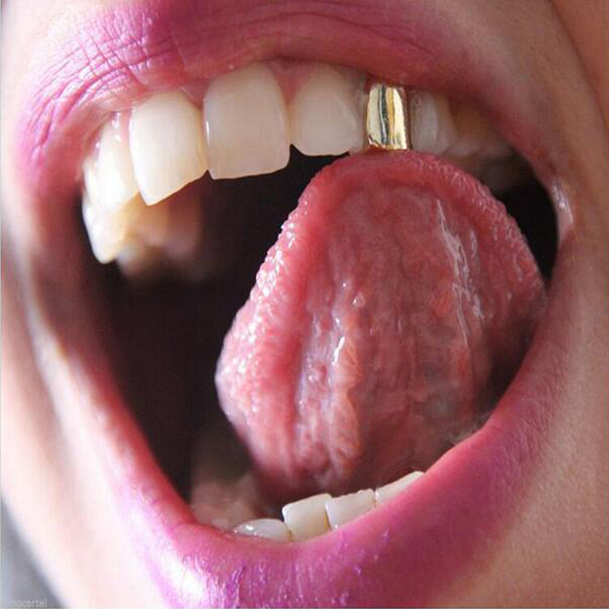 Silver Tooth Jewelry Grillz Hiphop Bling Silver Tooth Compatible with A$AP - Image 3