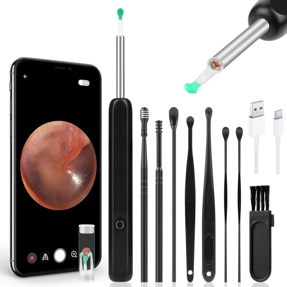 Wireless Smart Ear Cleaner with Camera for Safe Ear Inspection - Image 1
