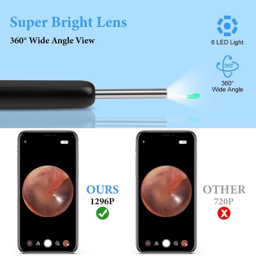 Wireless Smart Ear Cleaner with Camera for Safe Ear Inspection - Image 5
