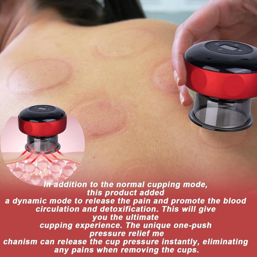 12-Speed Electric Cupping Therapy Machine Vacuum Massager Set, Red - Image 6
