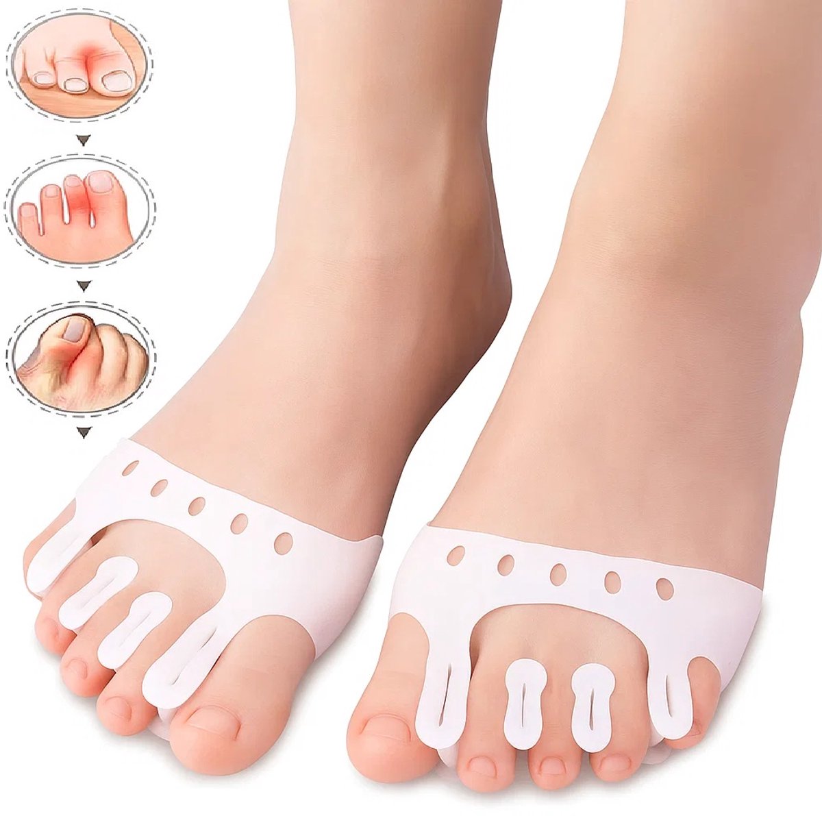 Silicone Toe Corrector 5-Hole | Toe Spreader | Hallux Valgus | Straighten Toes | Shock Absorbing | With Holes | White | 1 Pair - Image 1