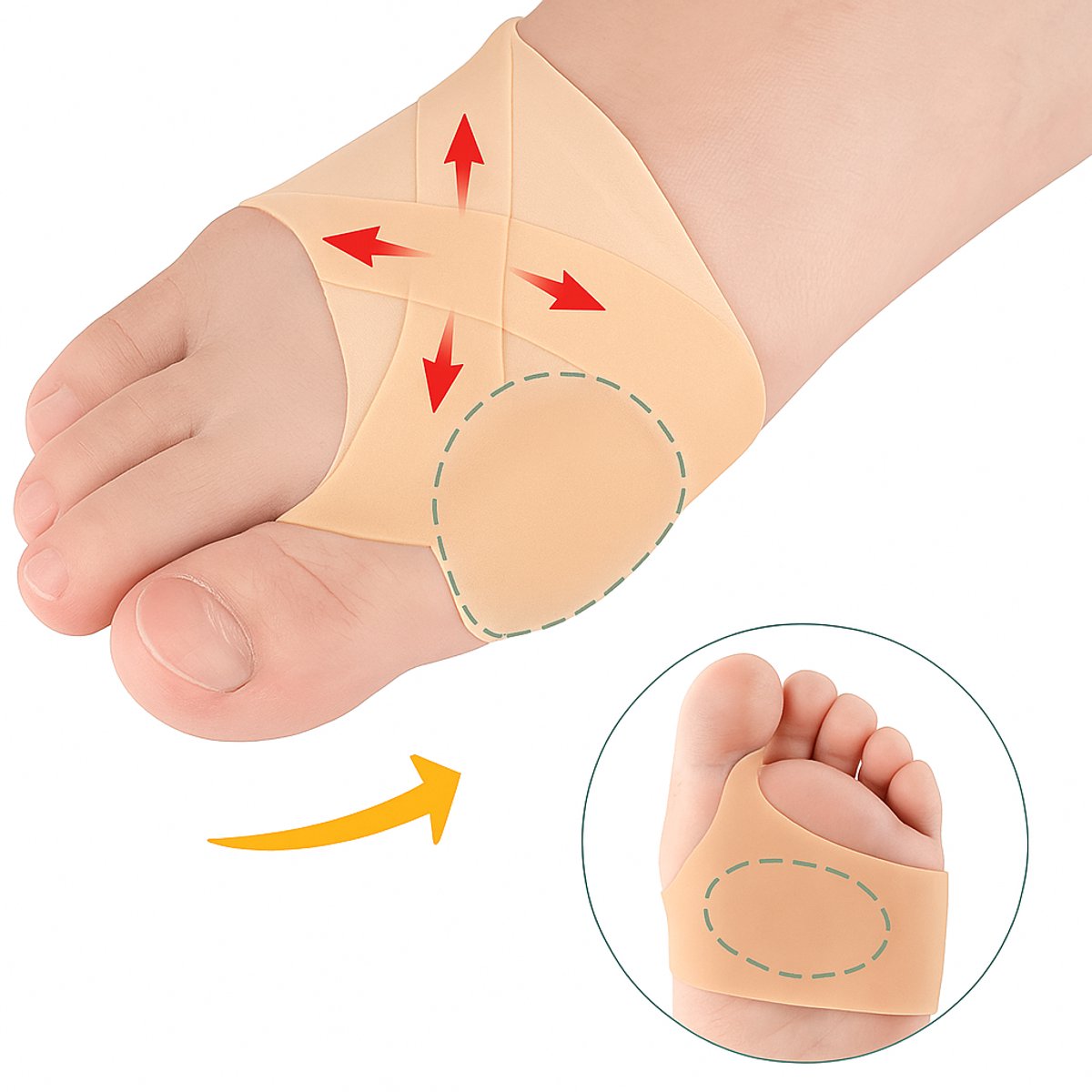 Hallux Valgus Silicone Toe Protectors | Toe Separators | Toe Corrector | Bunion | Bunion | Callus | Toe Straightening | 1 Pair | Beige - Image 1