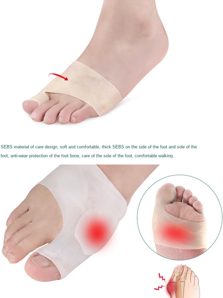 Hallux Valgus Silicone Toe Protectors | Toe Separators | Toe Corrector | Bunion | Bunion | Callus | Toe Straightening | 1 Pair | Beige - Image 3