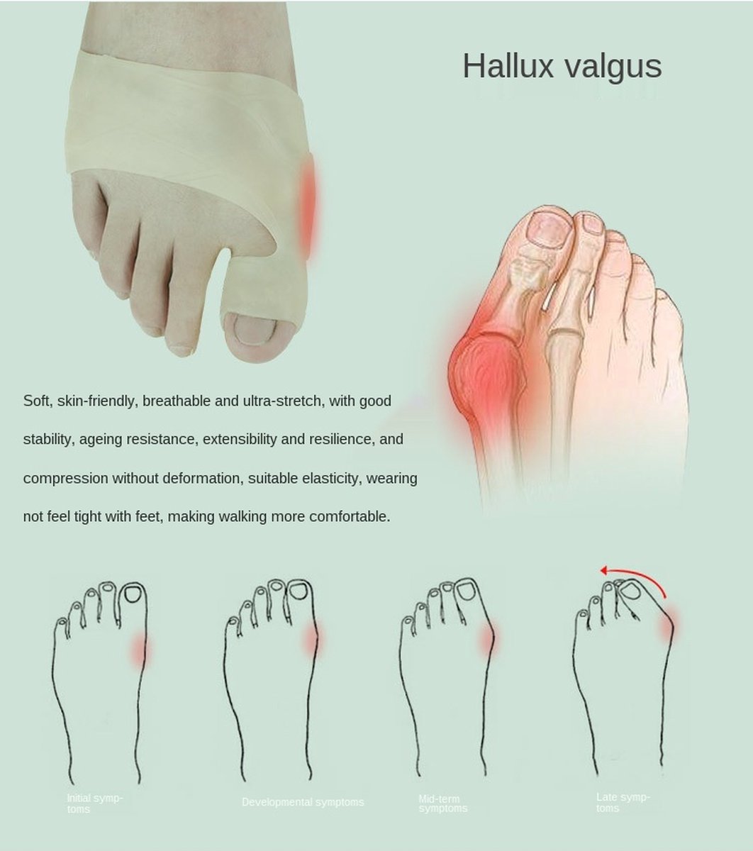 Hallux Valgus Silicone Toe Protectors | Toe Separators | Toe Corrector | Bunion | Bunion | Callus | Toe Straightening | 1 Pair | Beige - Image 4