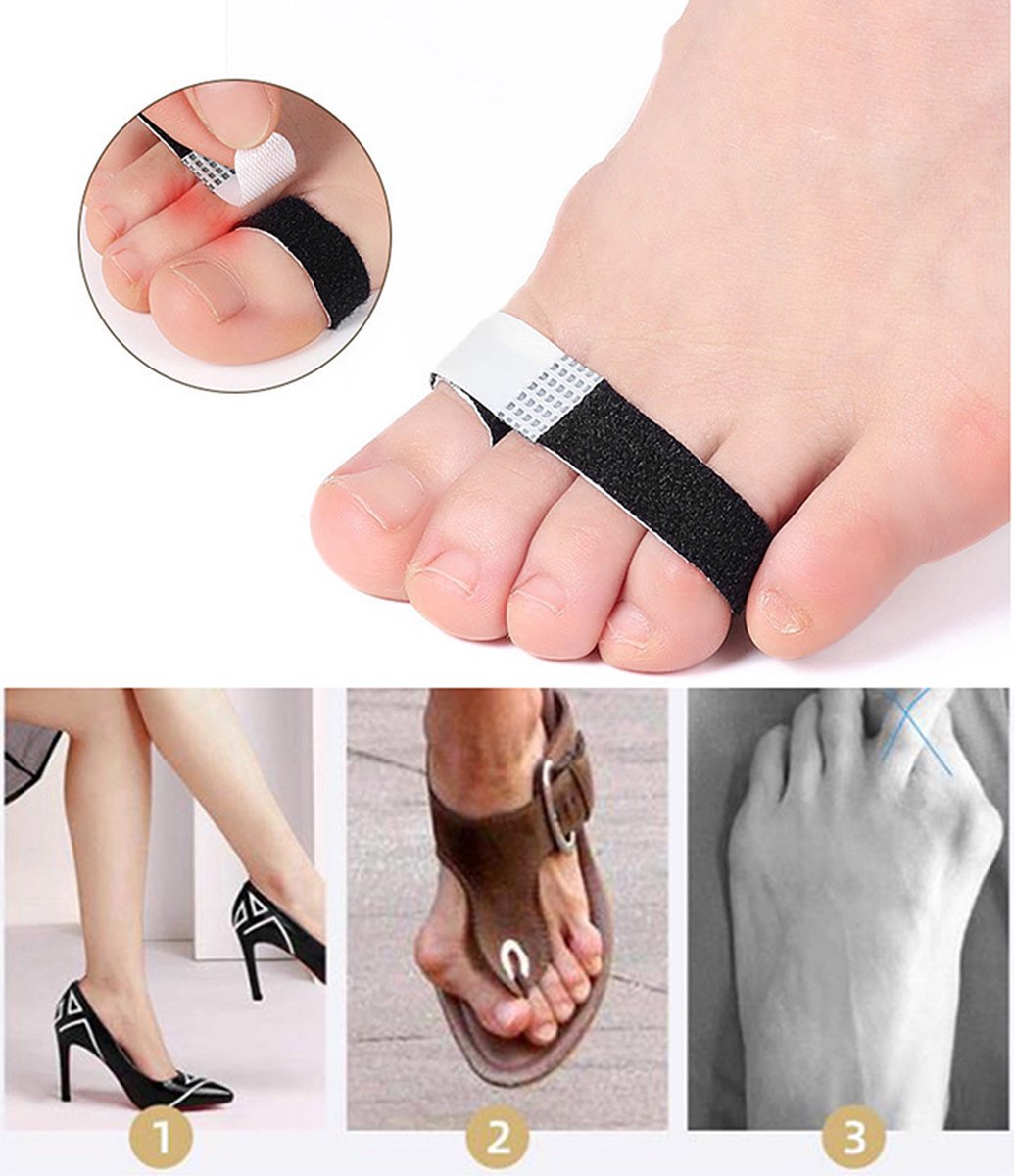 Toe Brace I Toe Bandage I Finger Brace I Finger Bandage I Toe And Finger Corrector I Toe Wrap I 1 Pair I White - Image 1