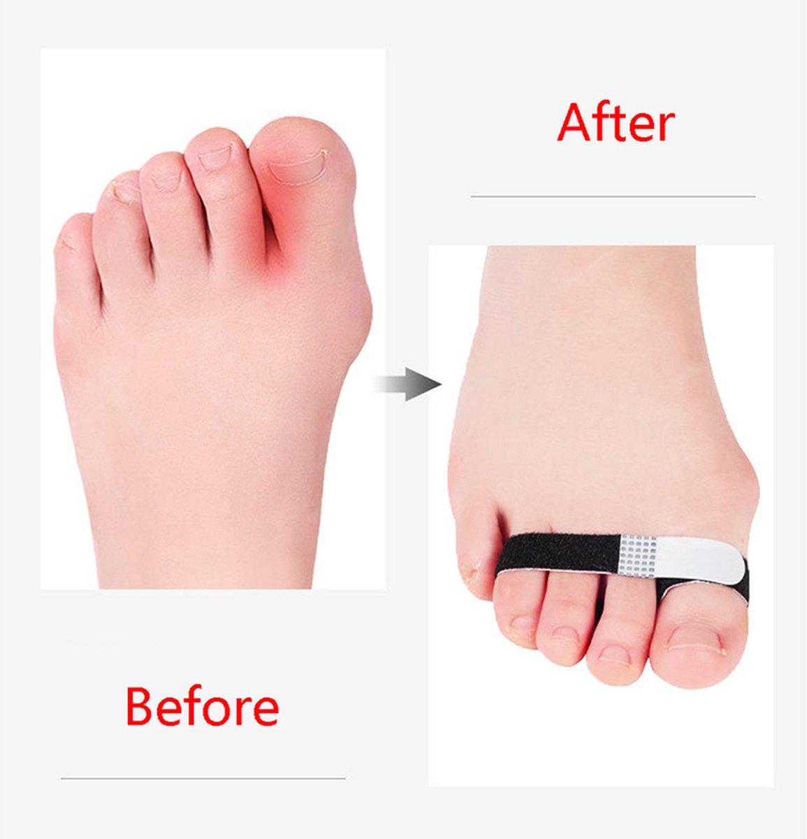 Toe Brace I Toe Bandage I Finger Brace I Finger Bandage I Toe And Finger Corrector I Toe Wrap I 1 Pair I White - Image 4