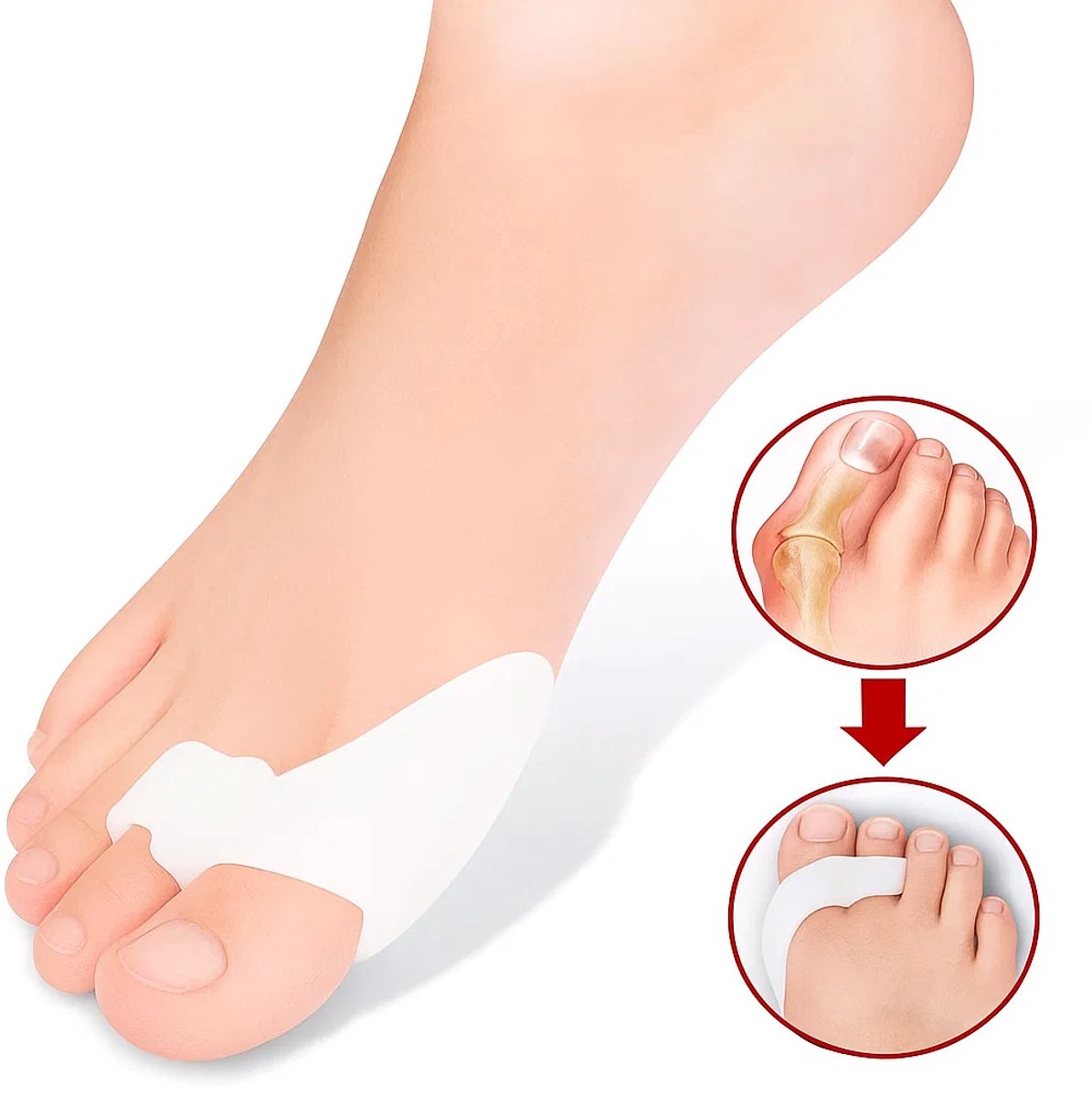 Silicone Toe Corrector | Toe Spreader | Hallux Valgus | Big and Little Toe Protector | 1 Pair - Image 1