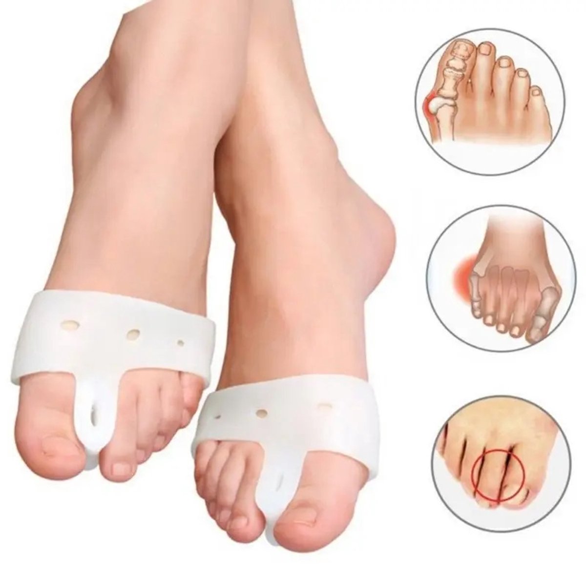 Hallux Valgus Silicone Toe Corrector | Toe Separator | Straighten Big Toe | Shock Absorbing | With Holes | White | 1 Pair - Image 2