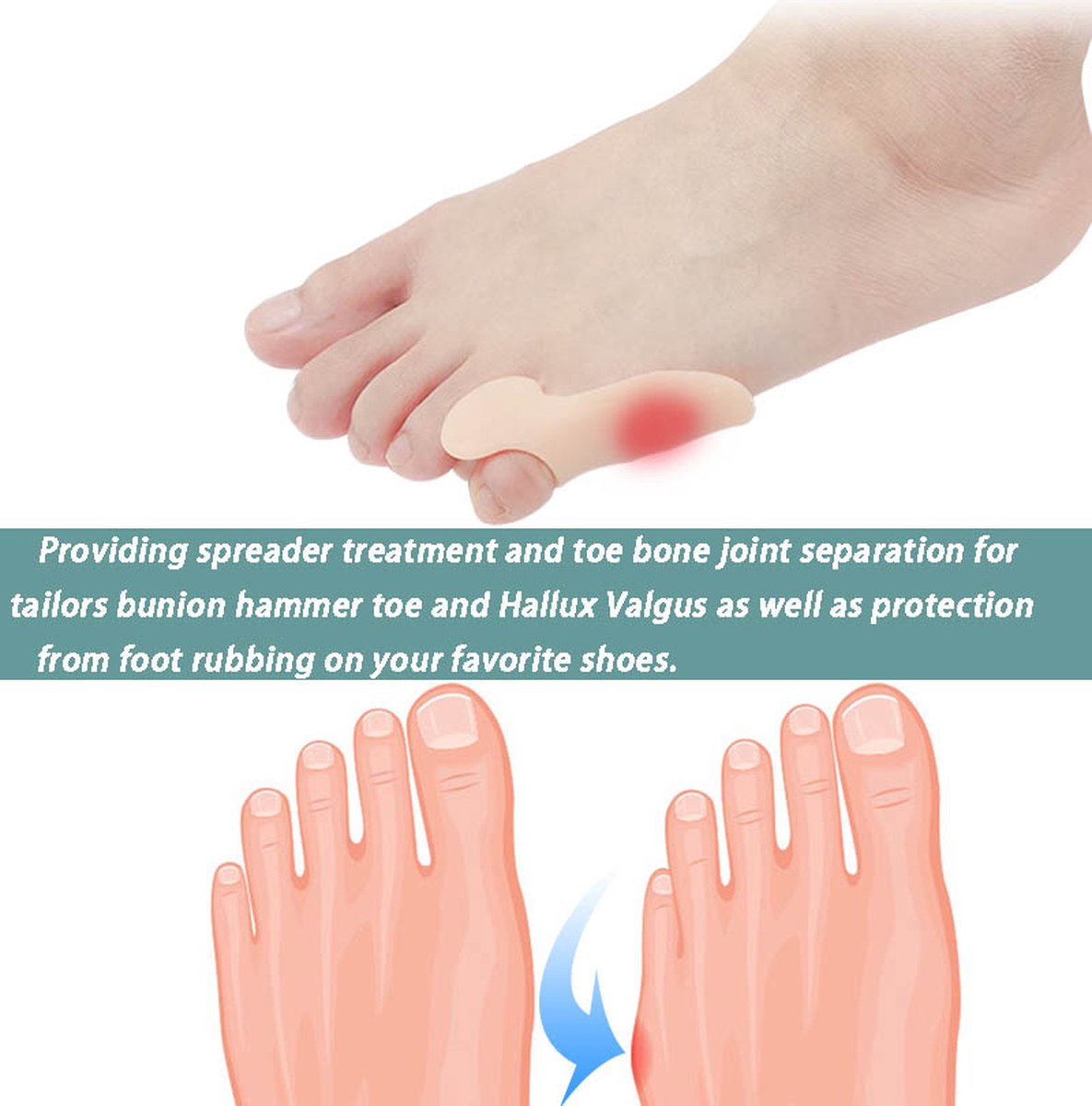Silicone Toe Corrector Little Toe | Toe Spreader | Little Toe Protector | 1 Pair | Beige - Image 3