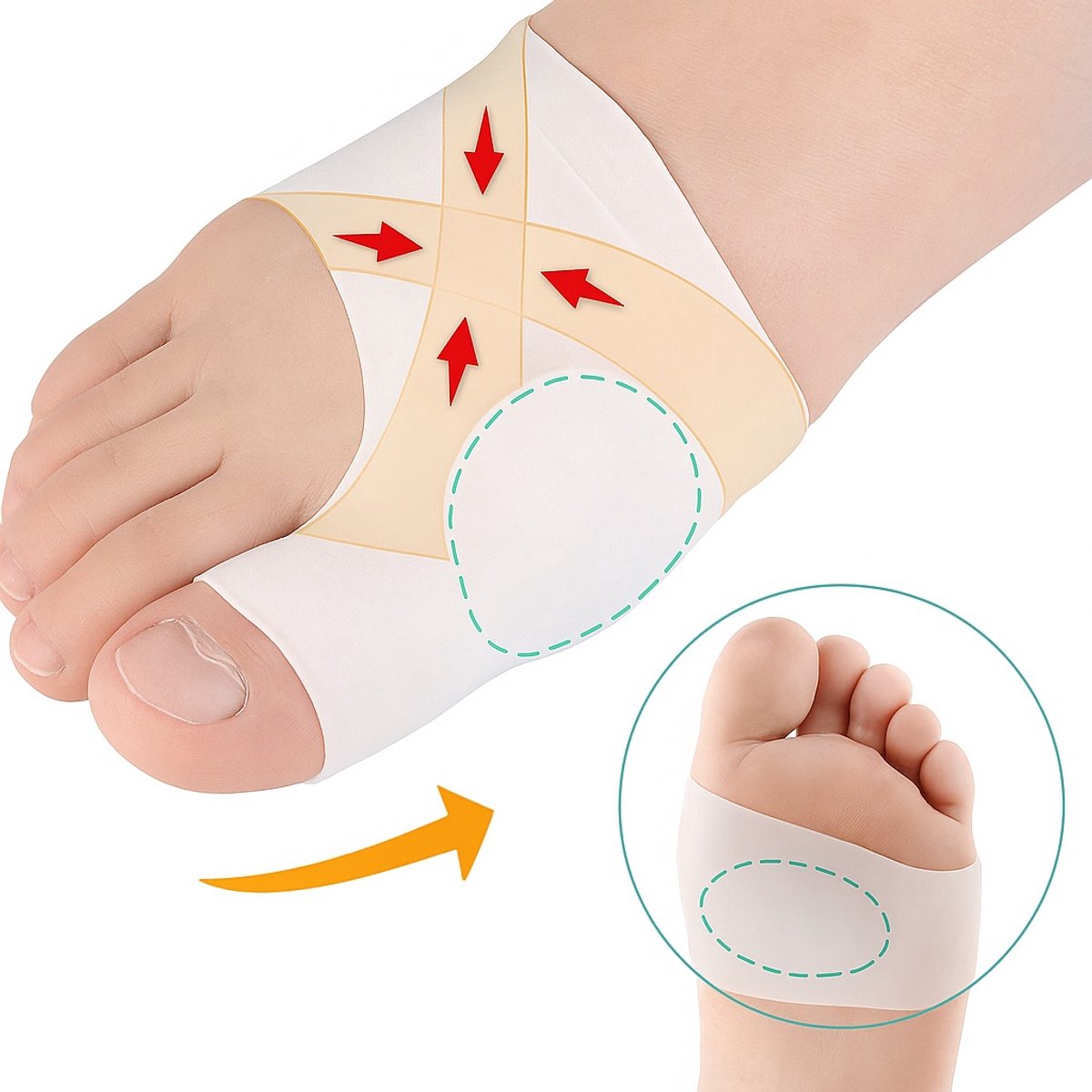 Hallux Valgus Silicone Toe Protectors | Toe Separators | Toe Corrector | Bunion | Bunion | Callus | Toe Straightening | 1 Pair | White - Image 1