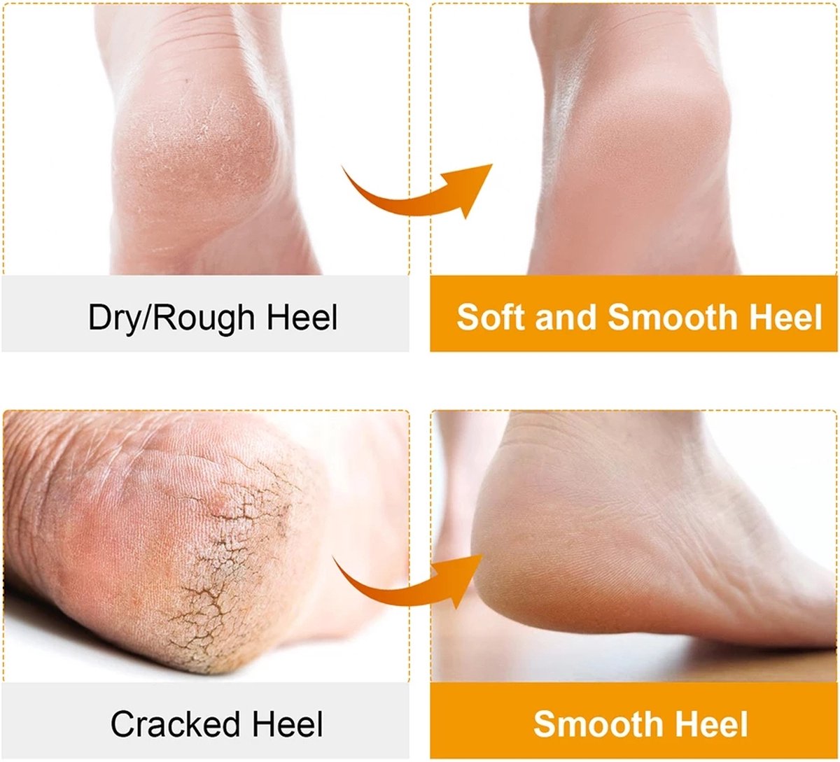 Silicone gel socks | Heel protectors | Heel insoles | Heel cushions | Heel socks | 1 pair | White - Image 3