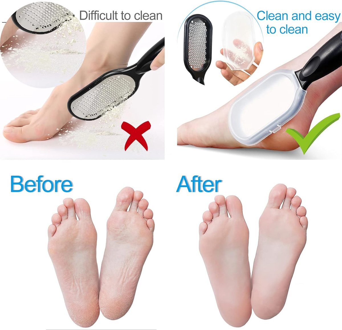 Professional Foot File - 2 Pieces - Callus File - Callus Rasp - Callus Shaver - Professional Callus Removers - Pedicure - Callus Rasp - Ergonomic Design - Stainless Steel - For Wet and Dry Use - Foot Care Callus - Callus Remover - Black and White - Image 3
