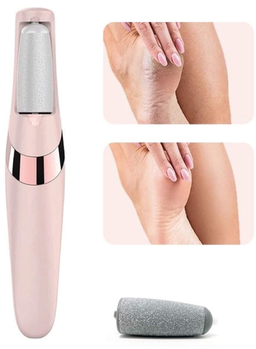 Foot Repair - Rechargeable Electric Callus Remover - Removes Dry Skin - For Smoother Feet - Image 1