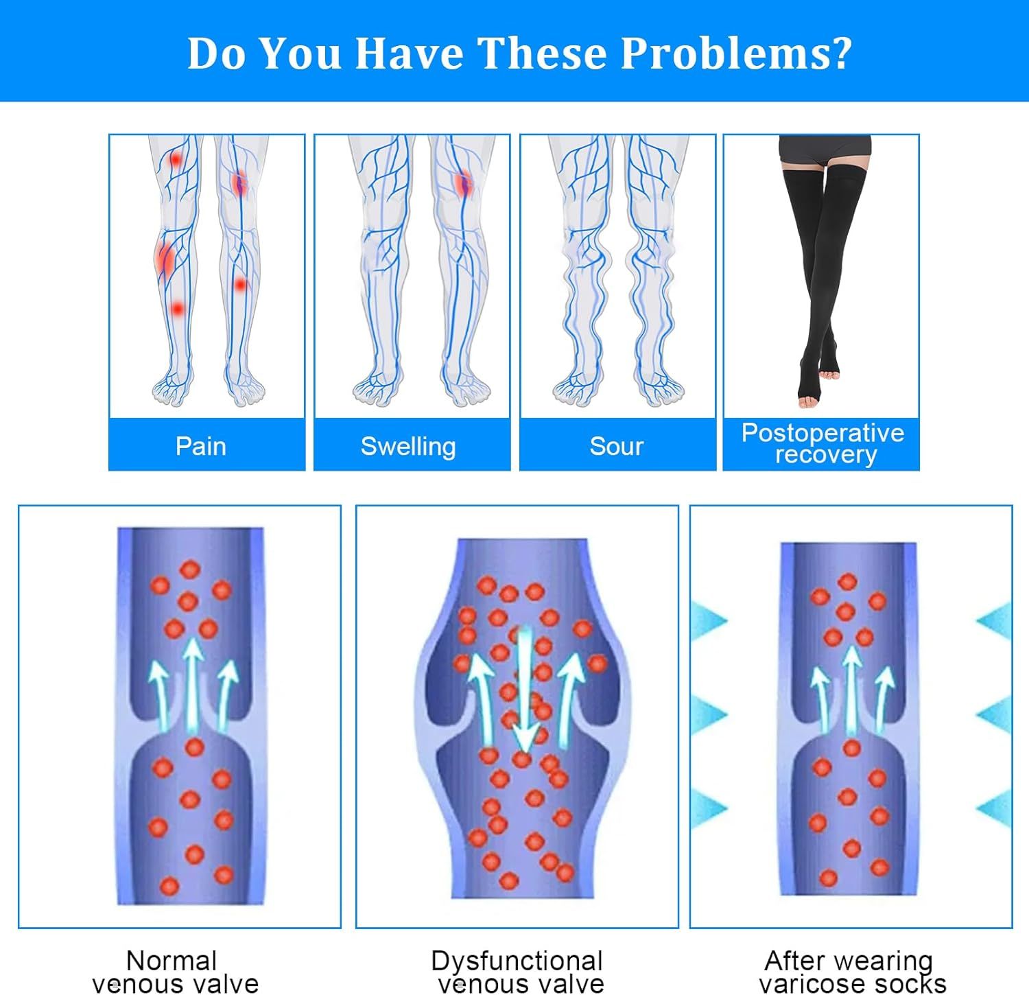 Thigh High Compression Socks for Women Men 23-32 mmHg Open Toe, Level 2 Support for Varicose Veins Edema, Breathable Cotton Spandex with Silicone Dotted Bands - Image 4