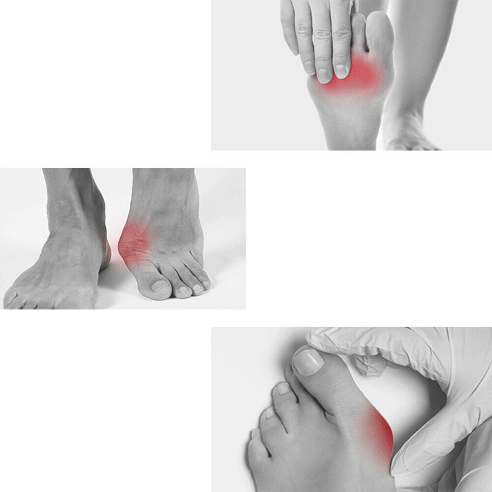 Onemayship Silicone Gel Toe Separator Orthotics Bunion Toes Spacer Pain Reliever 12Pcs - Image 6