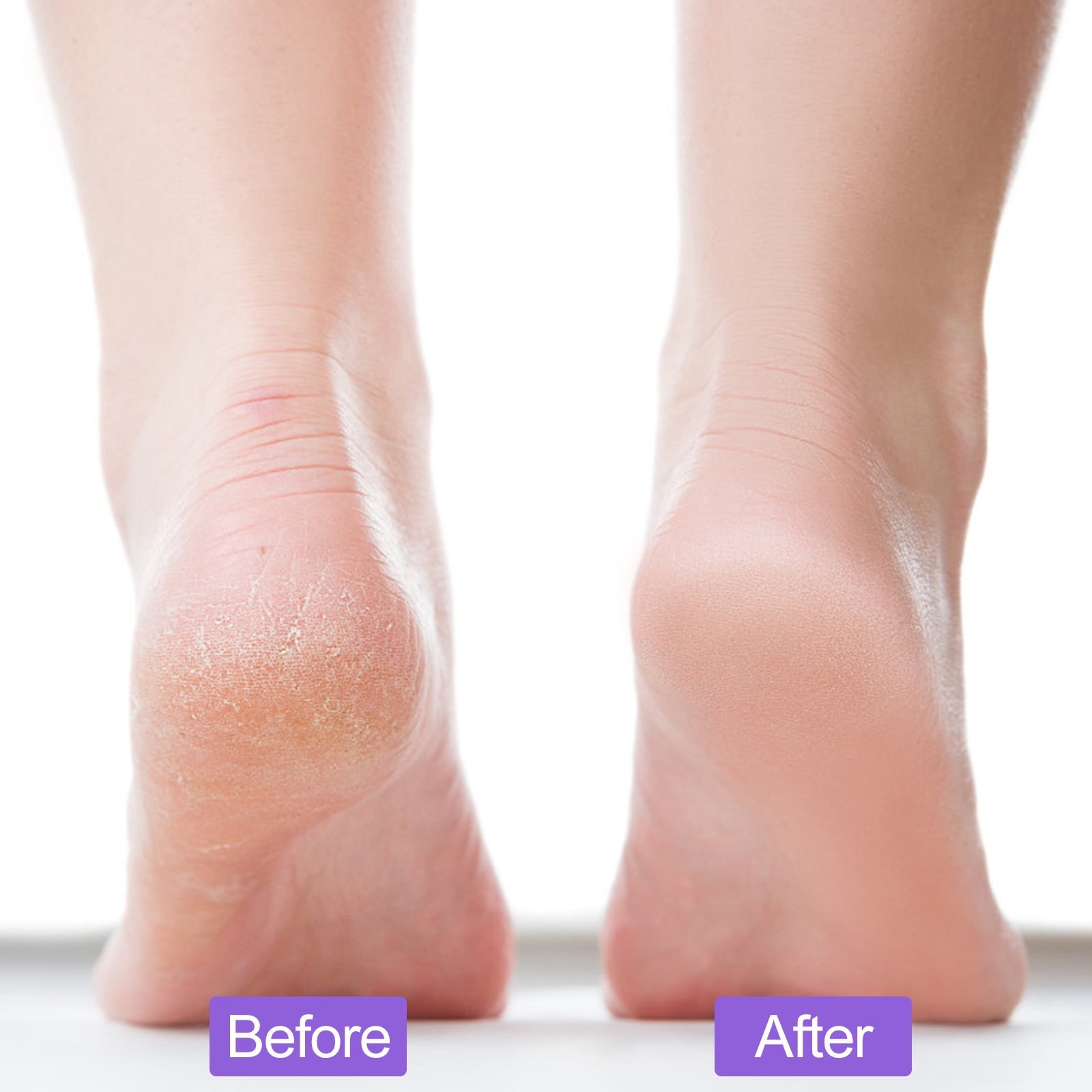 Clearance! PALIFEUR 2-Pack Foot Pumice Stone For Foot Callus Remover, Professional Pumice Stone for Feet Cracked Heel Dead Skin Remove 2 Sided Pedicure Tools Purple - Image 5