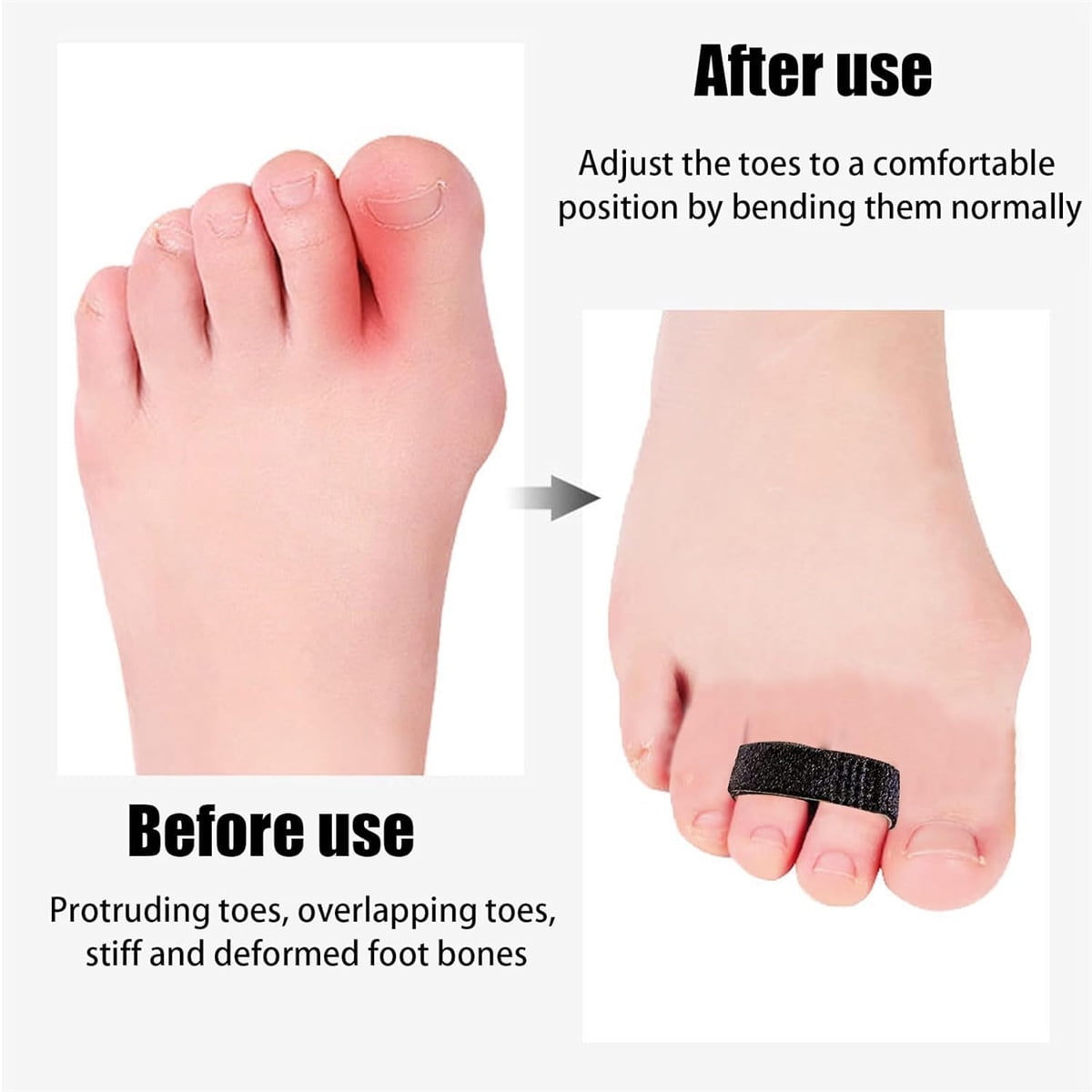 Hook and Loop Finger Wrap,Tutuviw 10 Pcs Washable and Reusable Buddy Straps for Fingers,Buddy Tape Finger Straps,Toe Separator for Bunion,Finger Brace for Injured/Jammed/Trigger Finger Support(Black) Black - Image 4
