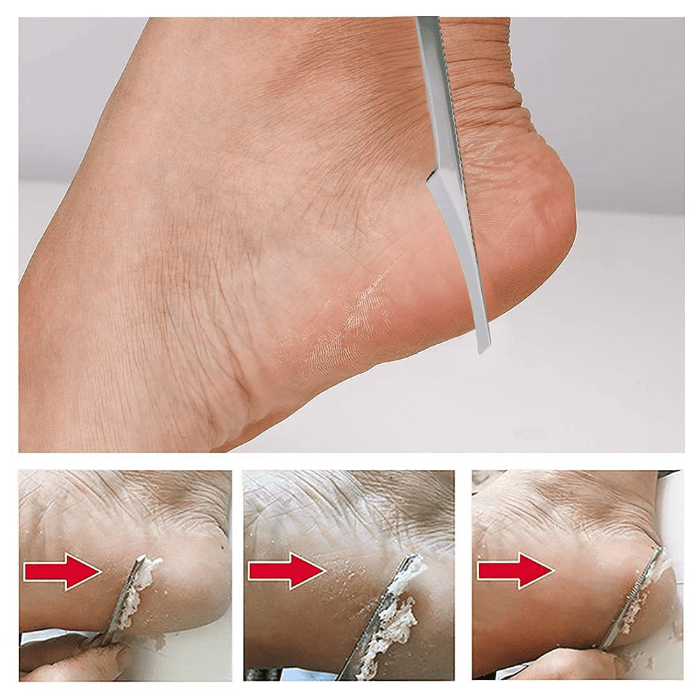 Tutuviw Foot Callus Shaver & Scraper Remover - Callous Removers for Feet Razor Tools with 10 Blades - Professional Pedicure Knife for Heel Hand Skin Care - Image 5