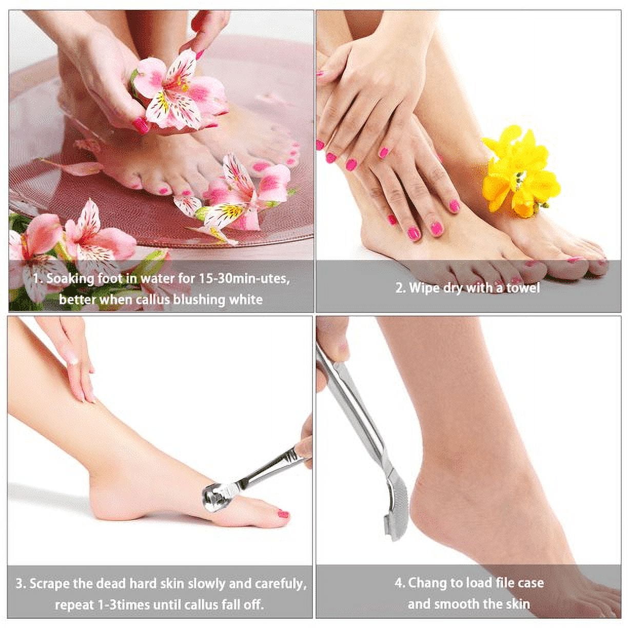 Tutuviw Foot Callus Shaver & Scraper Remover - Callous Removers for Feet Razor Tools with 10 Blades - Professional Pedicure Knife for Heel Hand Skin Care - Image 6