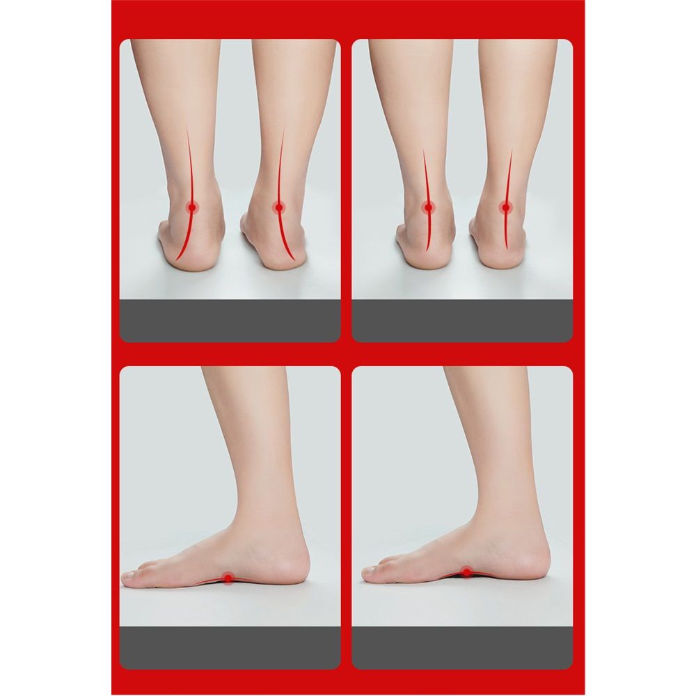 Shoe Pads 1 Pair Arch Support Inserts Plantar Insoles for Flatfoot Corrector Shoe Pads with Hole (White) Heel Spurs Insoles（L） - Image 5