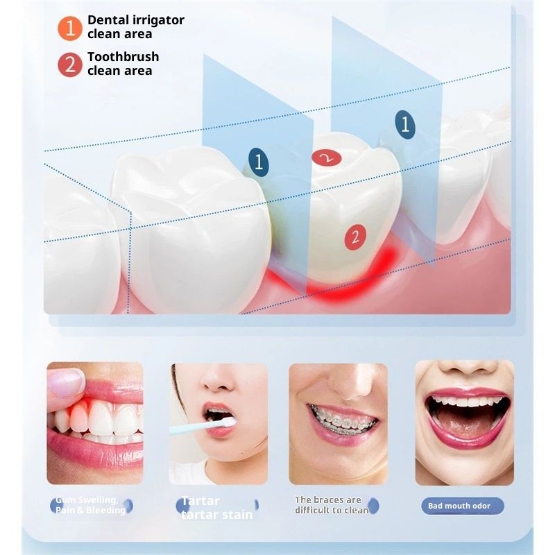 Mini Water Flosser for Travel, Ultra-Portable Cordless Oral Irrigator, IPX7 Waterproof 4 Modes, 180mL Teeth Cleaner for Tonsil Stones & Braces Care - Home & Travel - Image 3