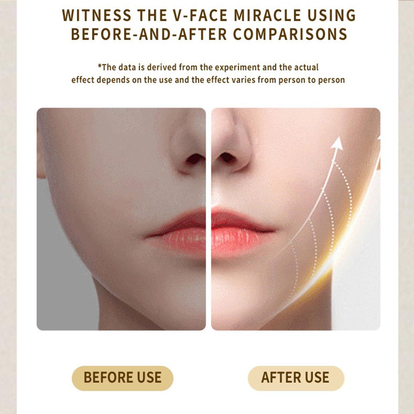 Intelligent Electric Double Chin and V-Shaped Face Machine with 12Adjustable Intensities - Women's V-Face Machine(white,25.6*4.5cm） - Image 2