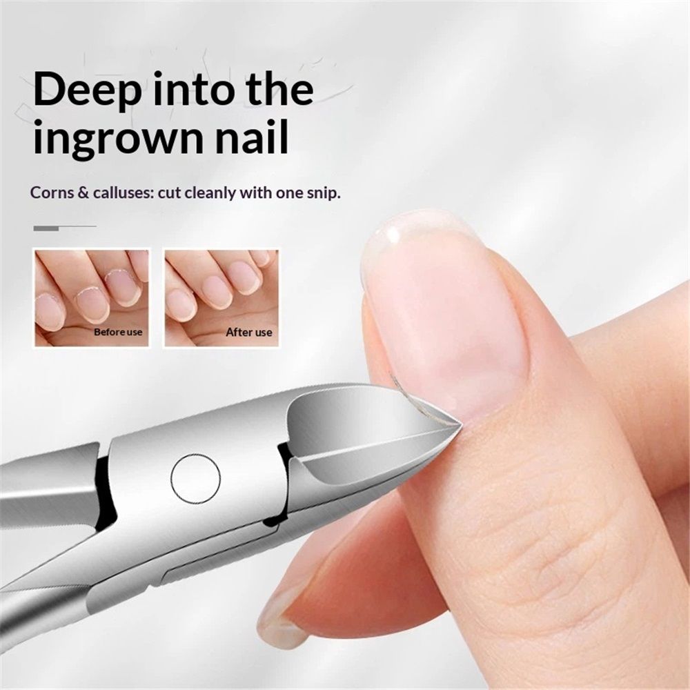 2 pack Professional Toenail Clipper for Thick or Ingrown Nails Surgical Grade Stainless Steel, Long Nail Clippers For Men Elderly - Image 2