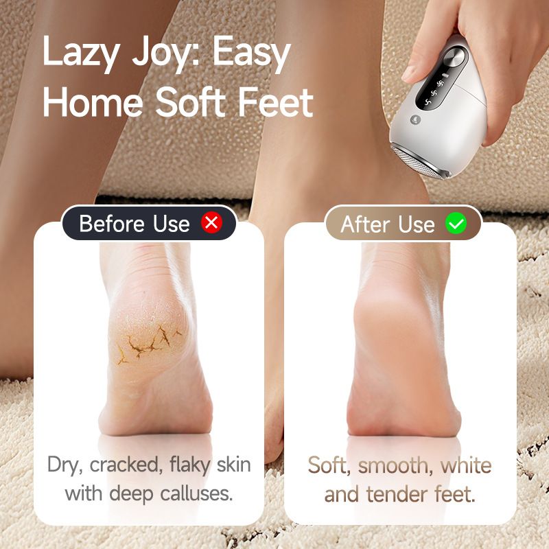 Smart Electric Foot File, 26000Pa Suction, Smooth in 3 Seconds, IPX6 Waterproof, Portable Foot Care/white - Image 5