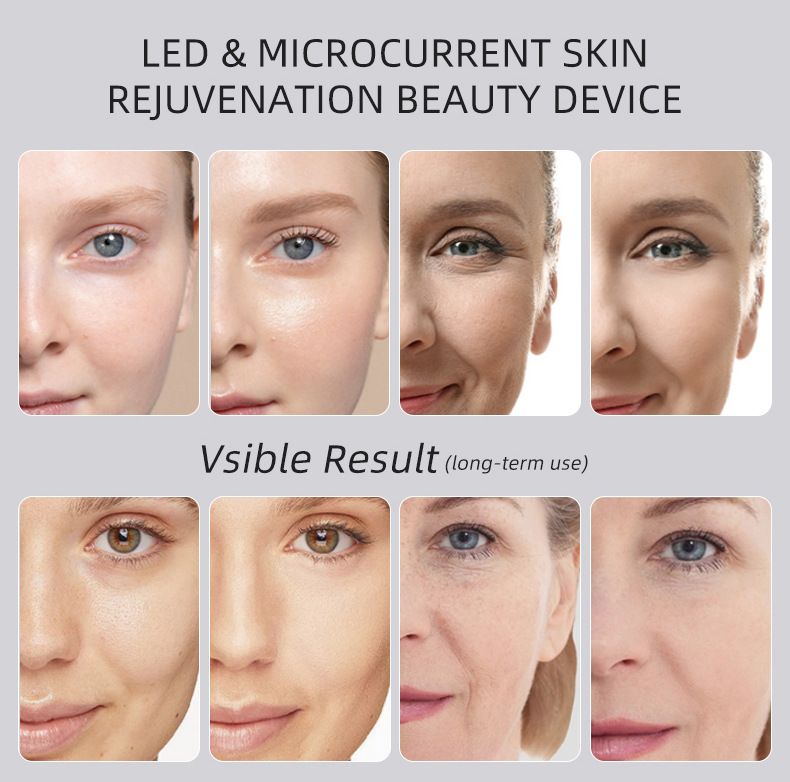 Beauty Device: Red and Blue Light, Home Use, Portable, Vibrating, Multi-Functional, with Voice Guidance, 5-Color Light Therapy, Eye Massage, Eye Care Device/