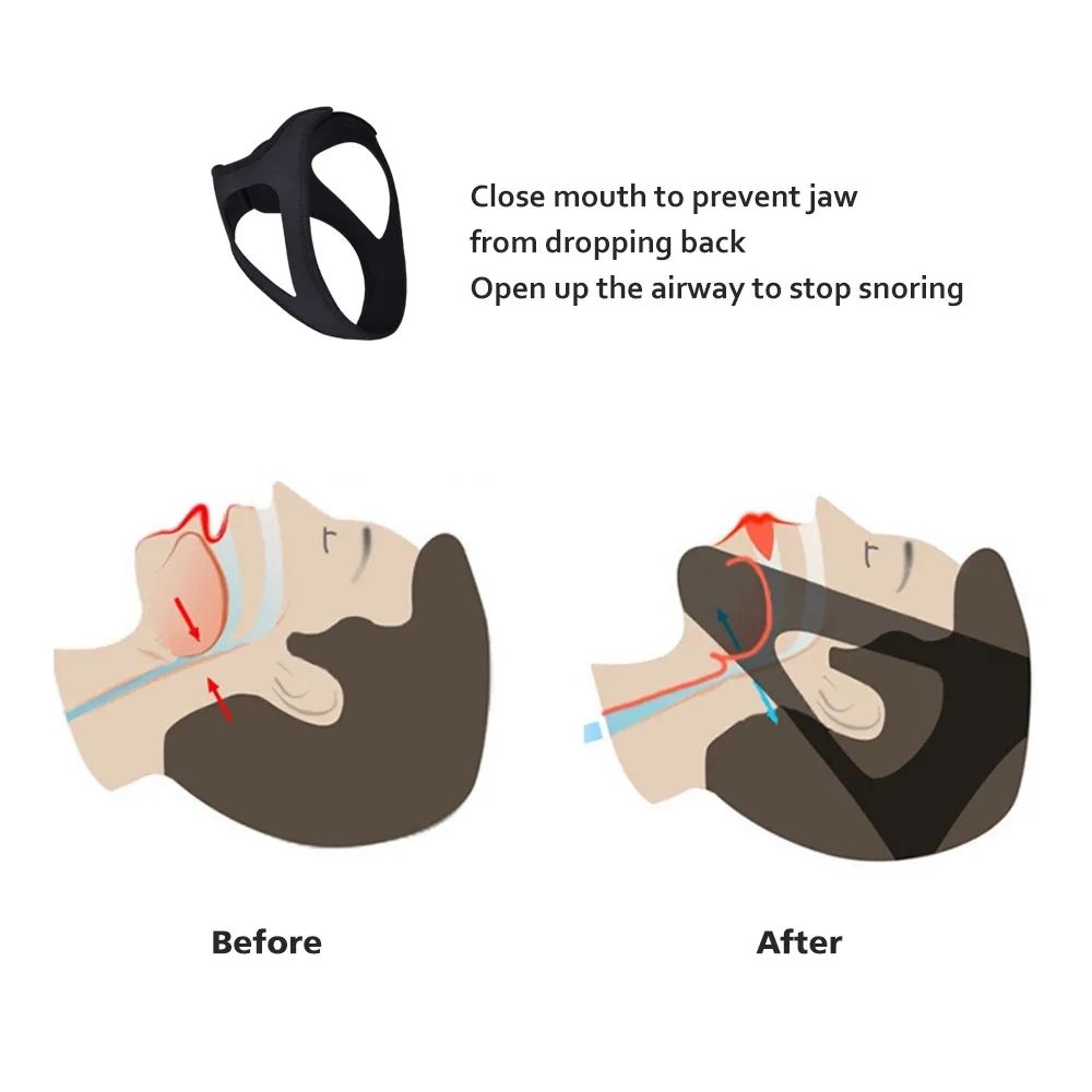 Adjustable Anti Snoring Chin Strap, Black, Stop Snoring Belt - Image 2