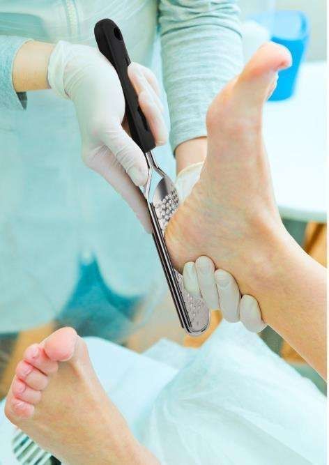 Black Stainless Steel Foot File, Smooth Feet With Style - Image 3