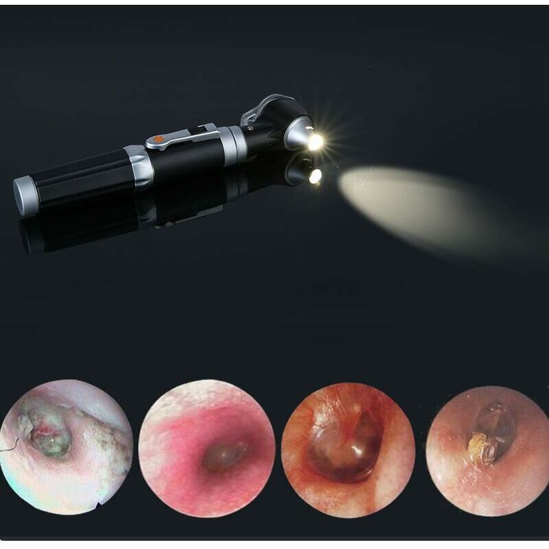Mini Ear Otoscope, Magnification Diagnostic Inspection Ear Scope with LED Direct Illumination Ear Healthy Tool for Doctors Nurse Children - Image 4
