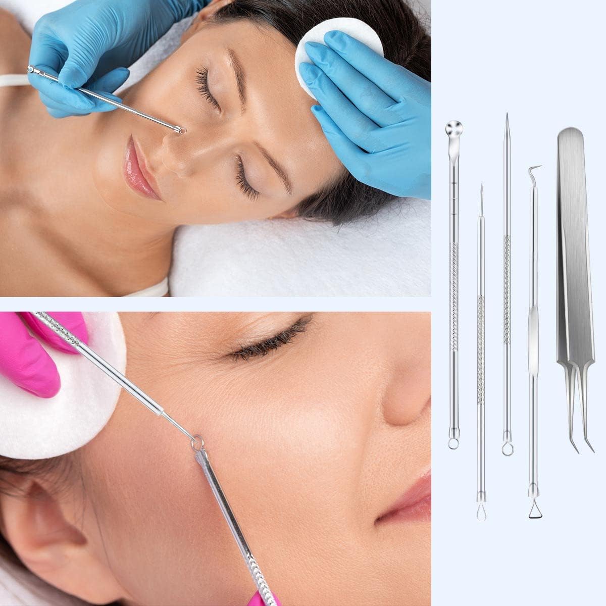Blackhead Remover Tool Pimple Popper Kit 5 Pack Extractor Tools with Case Comedone Zit Acne Blemish Whitehead Removal Professional Stainless Steel for Face Nose - Image 6
