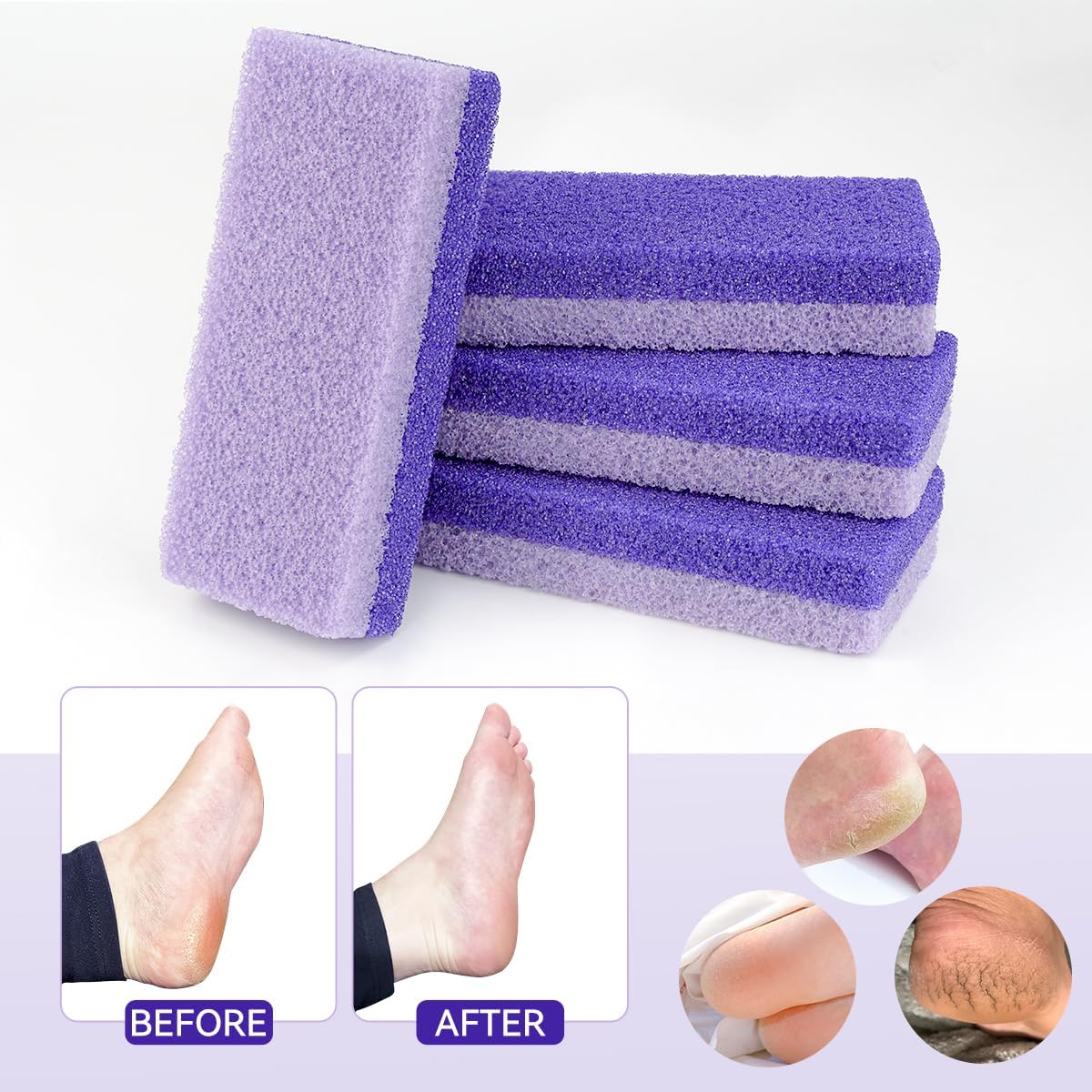 4 Pcs Foot Pumice Stone and Scrubber for Feet and Heels Callus and Dead Skins (Purple) - Image 5
