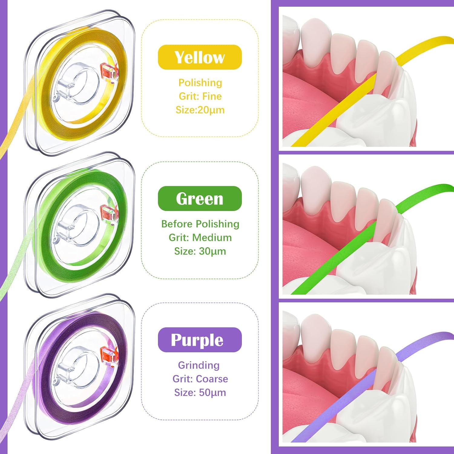 Amylove Dental Polishing Strips Tooth File 3 Rolls 4mm x 600mm Dental Polisher Teeth Sanding Grinding Deep Teeth Cleaning Tool Tooth Polish Abrasive Strip Oral Care(Coarse, Fine, Medium,Multi Color) - Image 3