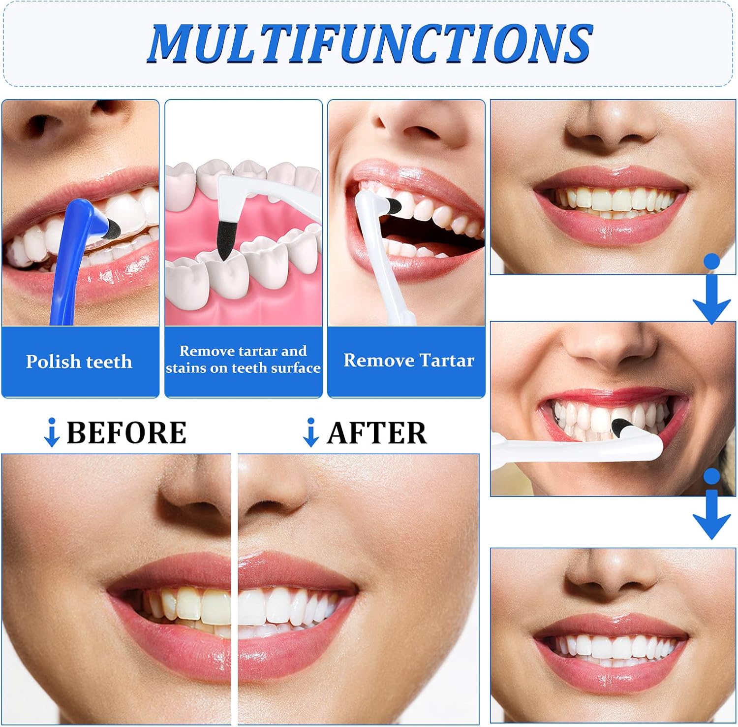 8 Pieces Tooth Stain Eraser Tooth Stain Removers Tartar Remover Plaque Remover for Teeth Dental Polisher Cleaning Kit for Whitening Polishing - Image 5