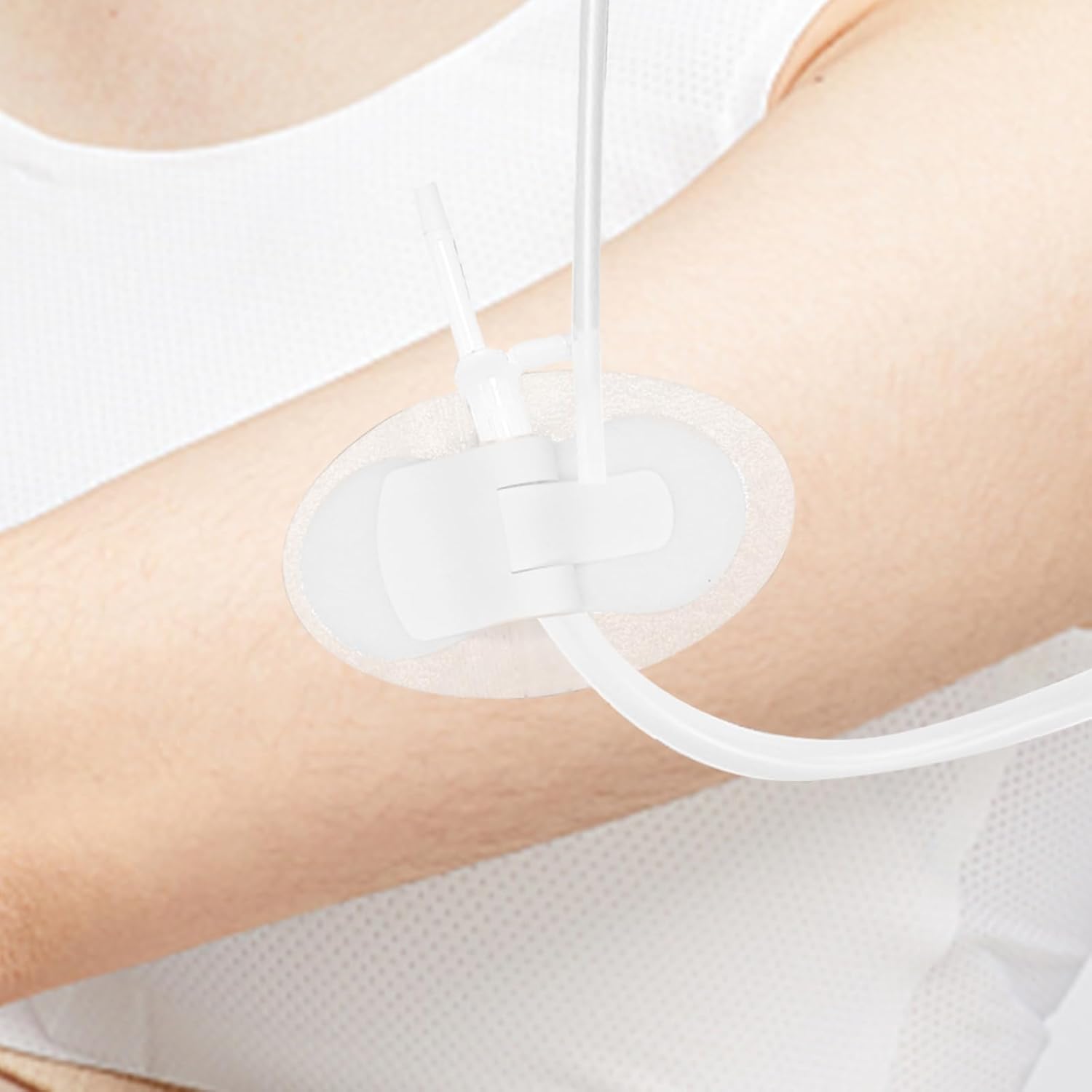 10Pcs Foley Catheter Stabilization Device, Urinary Catheter Leg Bag Holder, Adhesive Catheter Urinary Leg Bag Legband Holder, Urinary Catheter Hook and Loop Fixing Device Sticker Catheter Supplies - Image 4