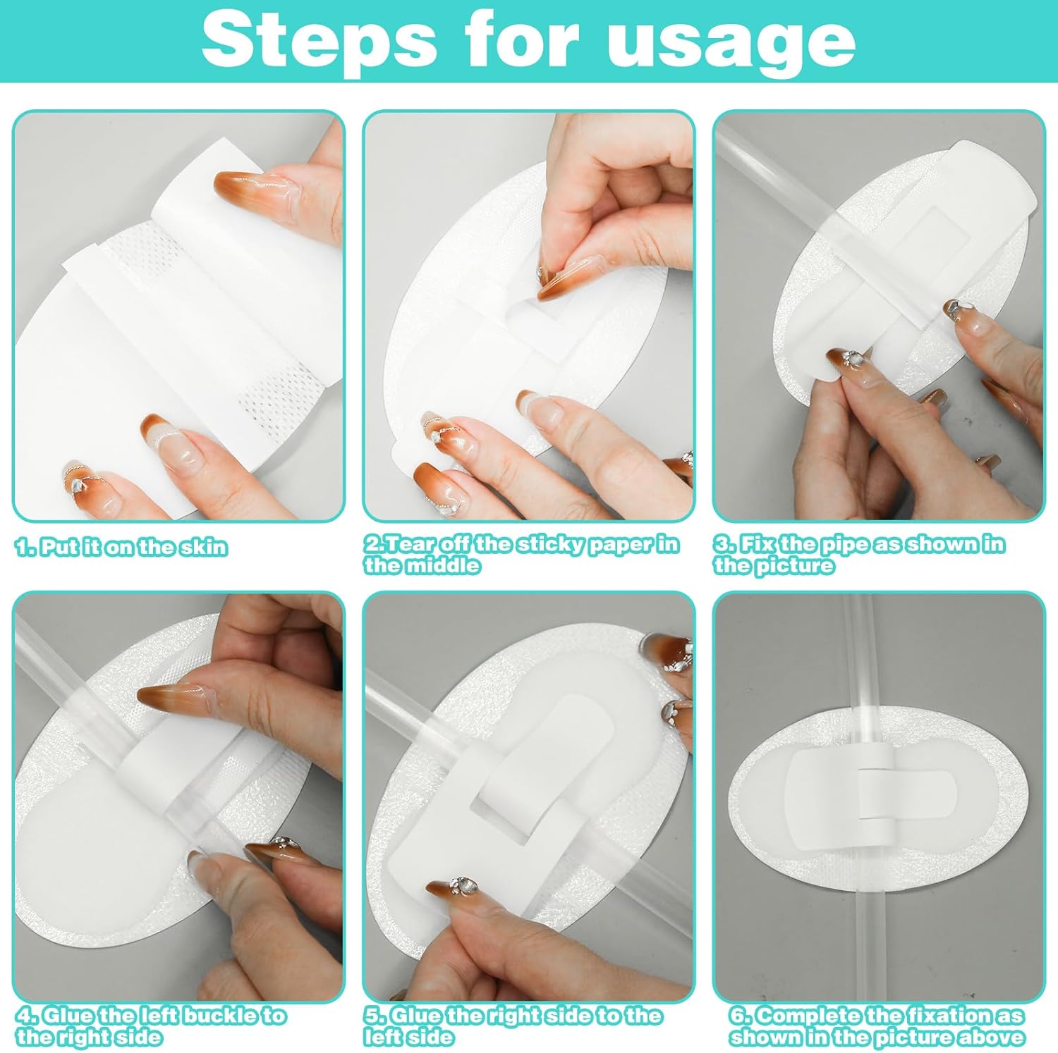 10Pcs Foley Catheter Stabilization Device, Urinary Catheter Leg Bag Holder, Adhesive Catheter Urinary Leg Bag Legband Holder, Urinary Catheter Hook and Loop Fixing Device Sticker Catheter Supplies - Image 5