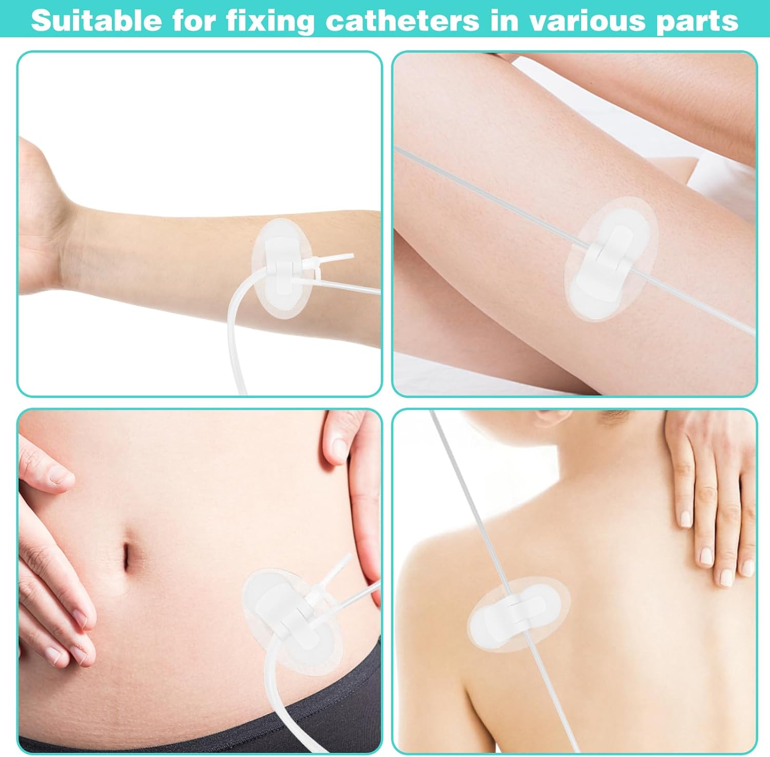 10Pcs Foley Catheter Stabilization Device, Urinary Catheter Leg Bag Holder, Adhesive Catheter Urinary Leg Bag Legband Holder, Urinary Catheter Hook and Loop Fixing Device Sticker Catheter Supplies - Image 6