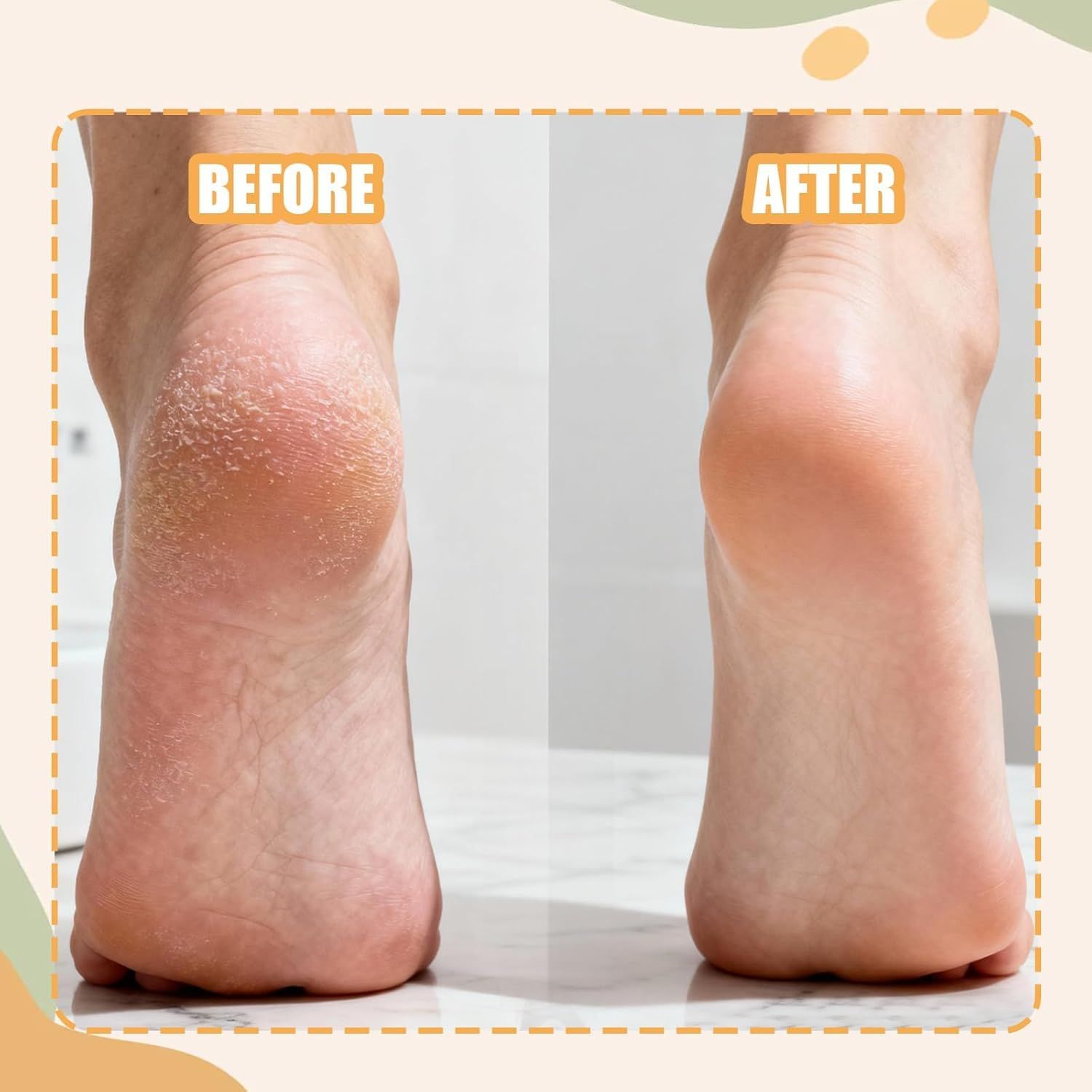 3PCS Precision Callus Remover & Bunion Scrubber for Toe Gaps, 2 Style Toe Callus Remover & Foot File Exfoliator with Compact Design for Pedicures and Sensitive Areas - Image 5